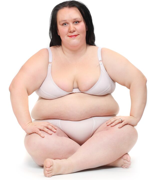 Mulher com sobrepeso